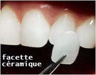 esthetique-dentaire-poitiers-montamise-2